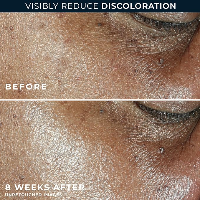 RoC Multi Correxion 5 in 1 Anti-Aging Daily Facial Moisturizer for Women and Men, Broad Spectrum SPF 30 & Shea Butter (1.7 oz) with Night Cream Packette (Packaging May Vary)-Velvo Beauty