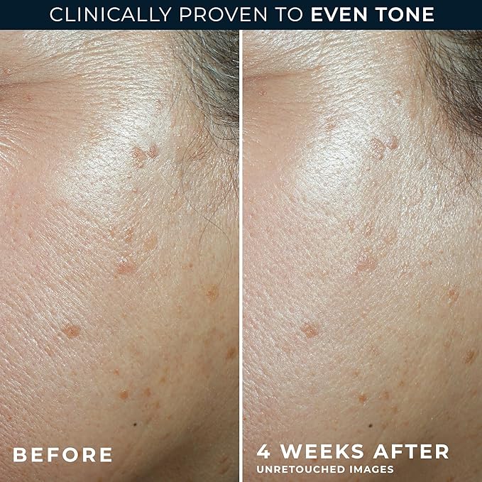 RoC Multi Correxion 5 in 1 Anti-Aging Daily Facial Moisturizer for Women and Men, Broad Spectrum SPF 30 & Shea Butter (1.7 oz) with Night Cream Packette (Packaging May Vary)-Velvo Beauty