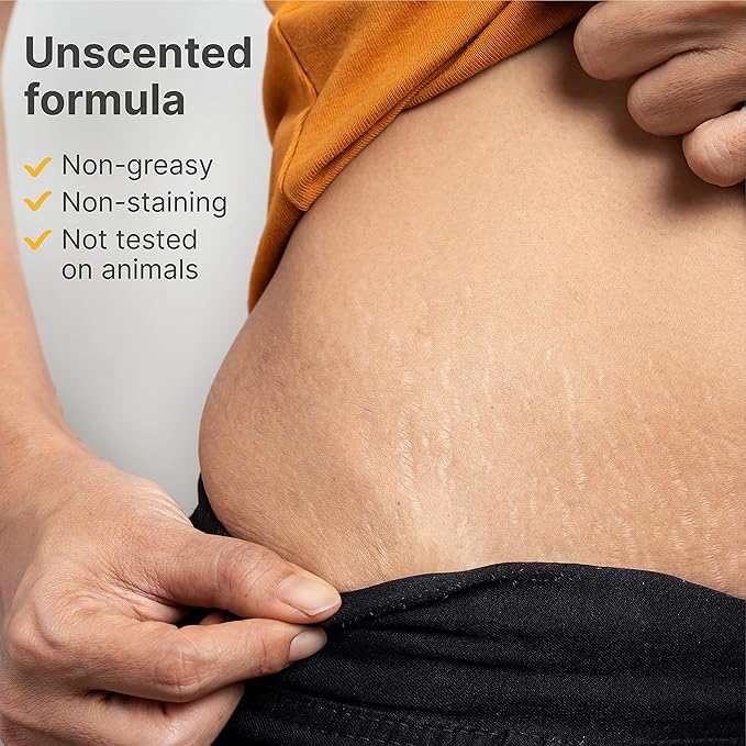 TriLASTIN-SR Intensive Stretch Mark Cream (5.5oz) Bundle with Nipple & Lip Balm (3pk) | Fast-Acting Stretch Marks Cream with Absorption Enhancing Serum | Breastfeeding & Ingesting Safe Balm-Velvo Beauty