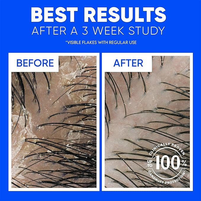 Head & Shoulders Classic Clean Dandruff Shampoo Twin Pack, Anti-Dandruff Daily Use, Paraben-Free, Color-Safe, 32.1 Fl Oz Each (Set of 2)-Velvo Beauty