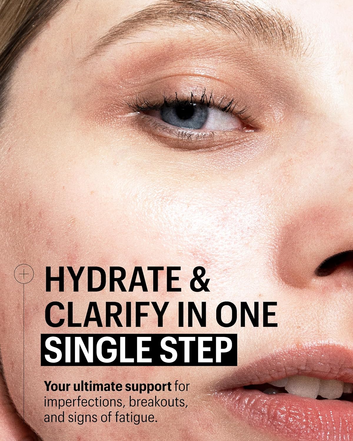 Allies of Skin Multi Nutrient & Dioic Renewing Cream: Moisturizer with Dioic Acid, 14 Antioxidants, Probiotics & Centella Asiatica. Targets Imperfections, Brightens & Protects Skin 1.7 oz / 50 ml-Velvo Beauty