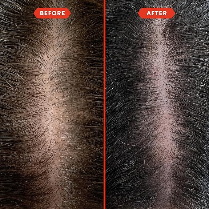 Fable and Mane Hair Oil - HoliRoots Strengthening Serum for Damaged, Frizzy Hair with Amla, Castor Oil for Hair Health - 3.4FL oz-Velvo Beauty